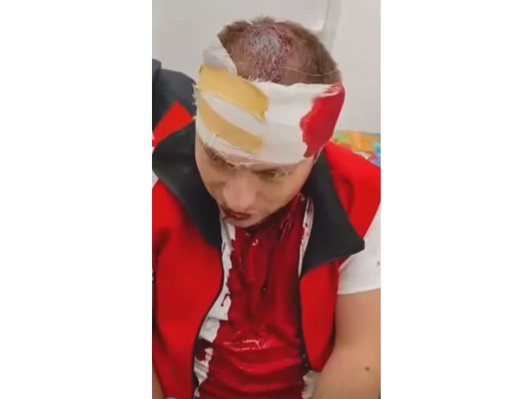 Опит за убийство след заснемане на екологичен проблем